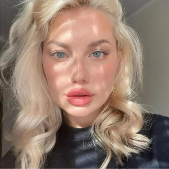 Meet your Posher, Duru - Picture 1 of 1